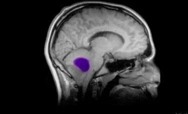 Un studiu masiv dezvăluie de ce tumorile cerebrale care au ”hipermutaţii” supravieţuiesc tratamentelor