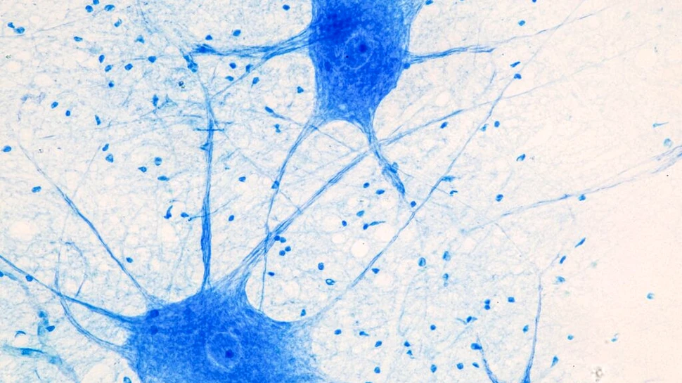 Iată de ce somnul profund îmbunătățește memoria!