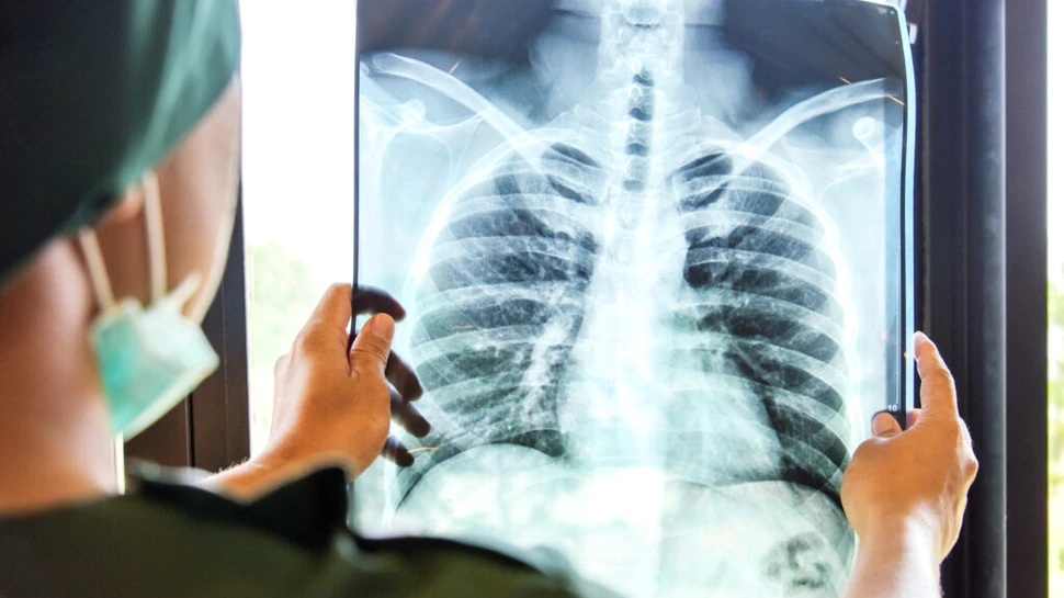 Prea multe cazuri de pneumonie, atrag atenția medicii. Care este cauza?
