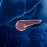 Cancerul pancreatic, depistat înainte să fie vizibil la tomografie. Ce aduce nou inteligența artificială