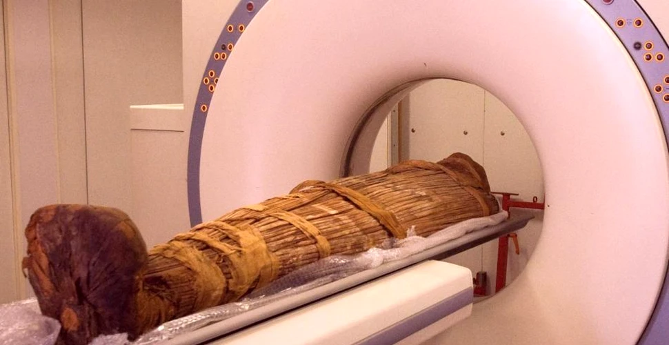 Ce este PET-CT şi când se recomandă în cancer