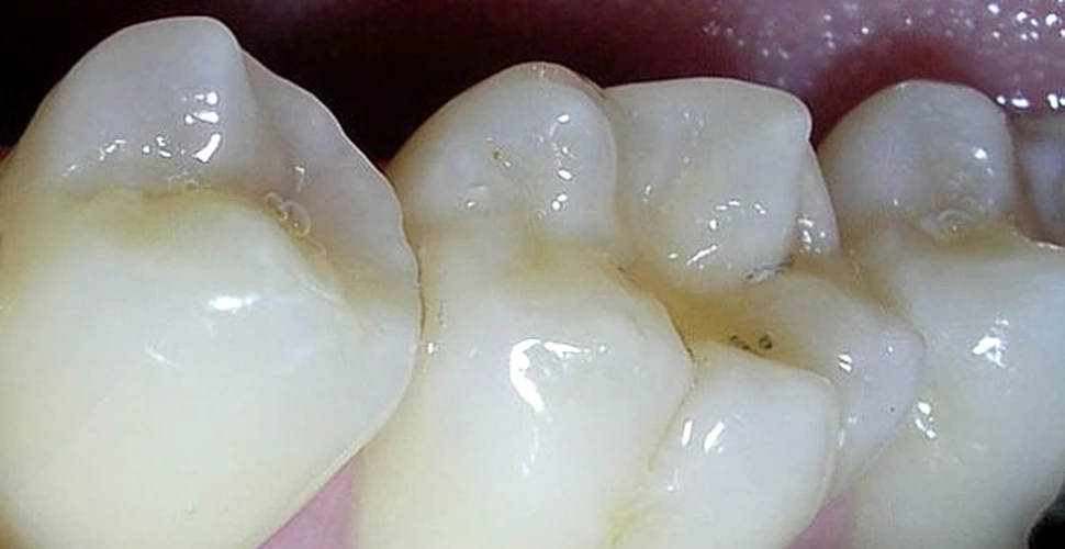 Gelul care repara dintii ne-ar putea scapa de chinul “plombelor”