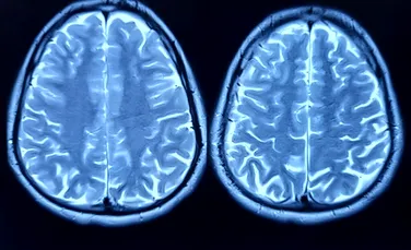 Celule cerebrale umane conectate la cipuri au jucat Doom, într-un experiment mai puțin obișnuit