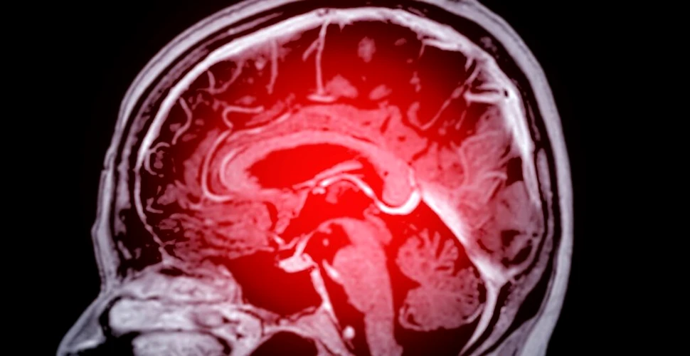 O nouă metodă de scanare cerebrală ar putea ajuta pacienții cu epilepsie rezistentă la medicamente