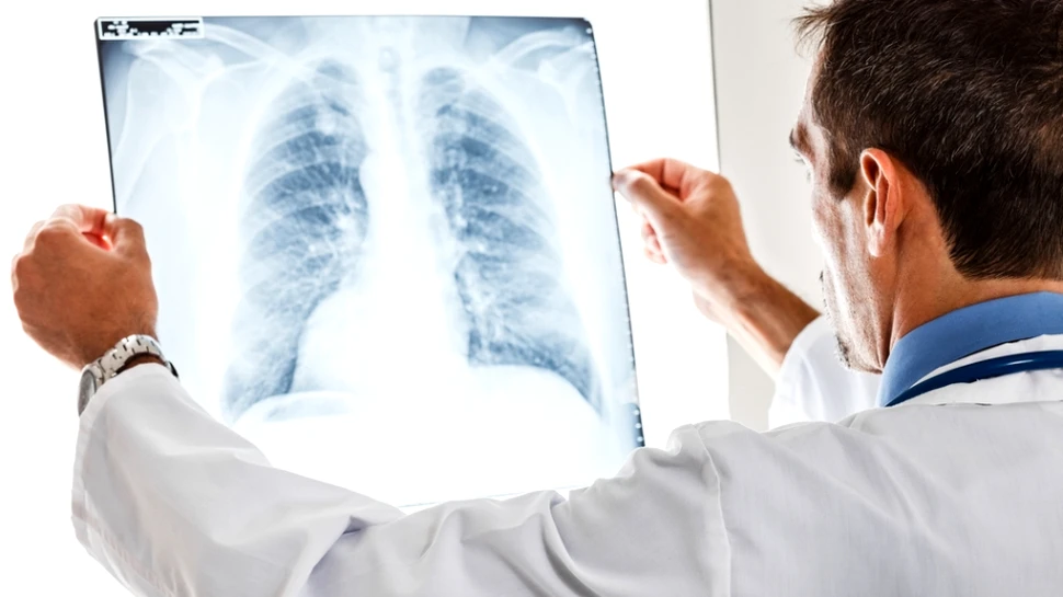 Simptomele şi metodele de prevenire ale embolismului pulmonar