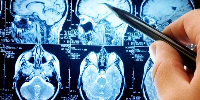 Oamenii de știință descoperă un circuit cerebral care poate opri durerea cronică