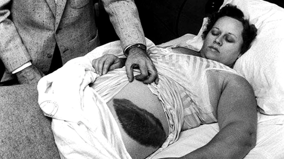 Ann Hodges, singura persoană lovită de un meteorit