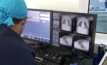 O procedură unică în vestul României pentru diagnosticarea cancerului pulmonar