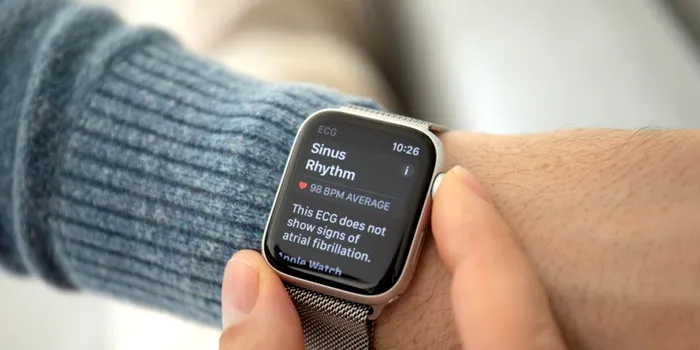 Oameni de știință din SUA: Ceasurile Apple care monitorizează funcția cardiacă declanșează alarme false