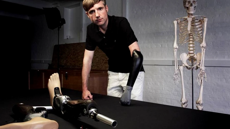 Uluitoarea realizare a ştiinţei: omul bionic a fost creat din organe şi membre artificiale (VIDEO)