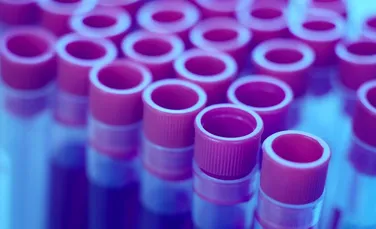 Un test de sânge depistează 5 tipuri de cancer cu până la patru ani înainte de stabilirea diagnosticului