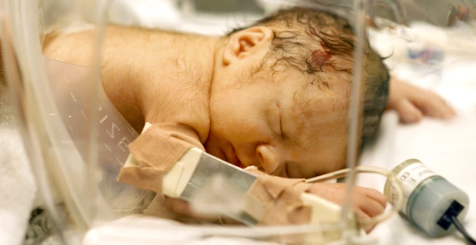 Un bebeluş s-a născut cu o „coadă” lungă de 12 cm. Ce era de fapt această excrescenţă? (FOTO)