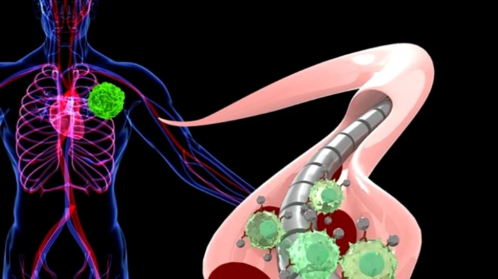 Un nou tip de ”test de sânge” ar putea detecta cancerul. Cum funcţionează firul magnetizat