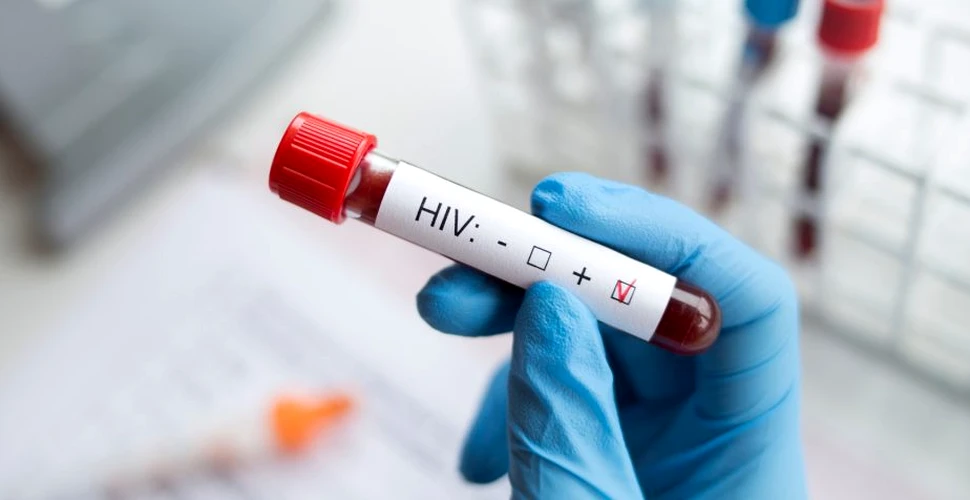 O femeie s-ar fi vindecat în premieră de HIV folosind un tratament nou cu celule stem
