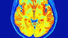 Oamenii de știință au modificat structura moleculară a LSD-ului și au creat un nou medicament pentru creier