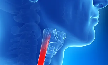 Premieră pentru România şi Europa de Sud-Est: o operaţie inovatoare pentru o boală rară la esofag