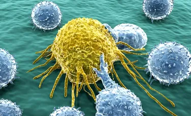 Supravieţuitorii limfomului Hodgkin din copilărie sunt expuşi unui risc major de apariţie al altor tipuri de cancer