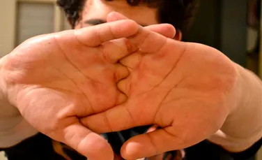 Ce se întâmplă atunci când ne trosnim degetele? Acest obicei are efecte negative sau nu? VIDEO