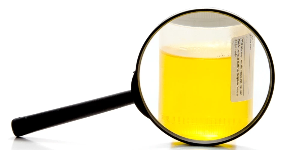 A fost descifrată compoziţia chimică a urinei umane, după 7 ani de cercetări