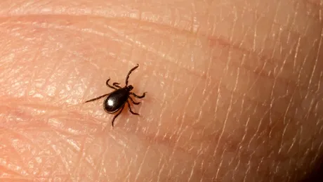 Inteligență Artificială detectează boala Lyme cu o precizie de 90%