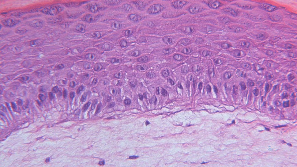 Pielea umană artificială deschide calea către o nouă terapie împotriva cancerului de piele