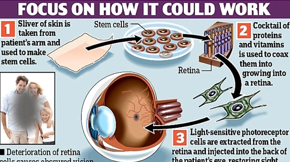 Retina creată din celule stem, primul pas spre ochiul creat în laborator
