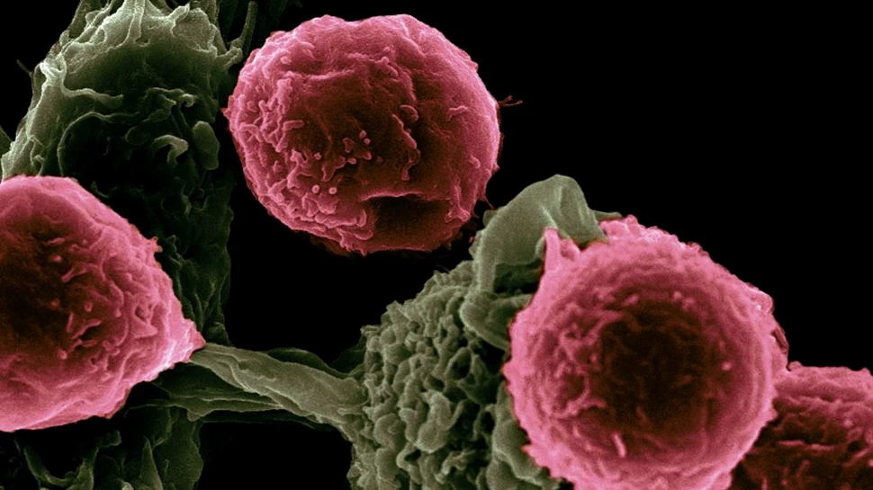 Cadrele medicale care tratează pacienţii cu cancer, posibil pericol pentru aceştia – studiu