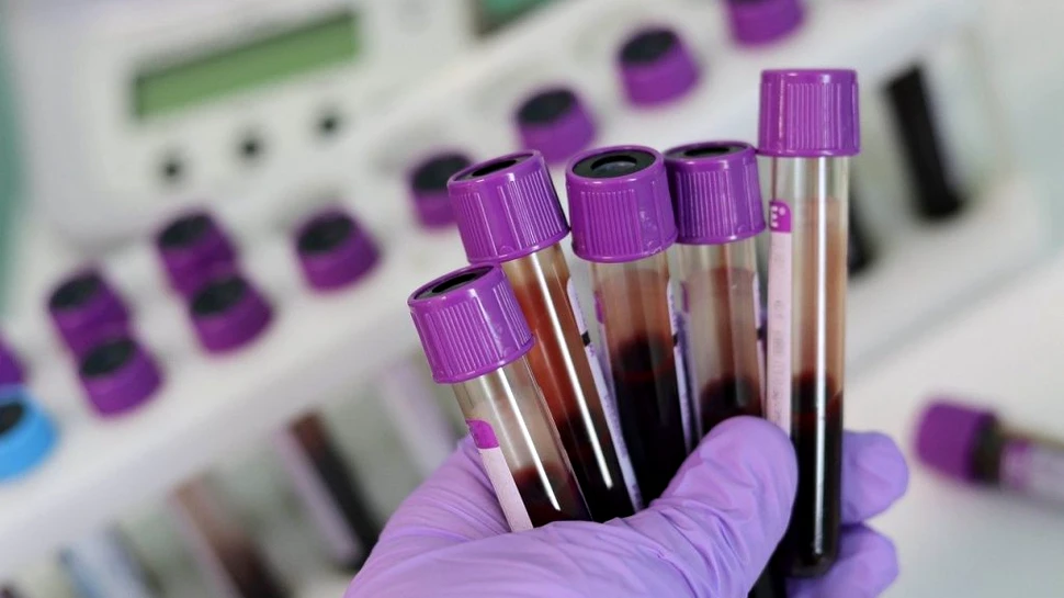 Primul dispozitiv portabil de testare a sângelui care îți arată dacă ai suferit o contuzie cerebrală, în doar 15 minute, a fost aprobat de FDA