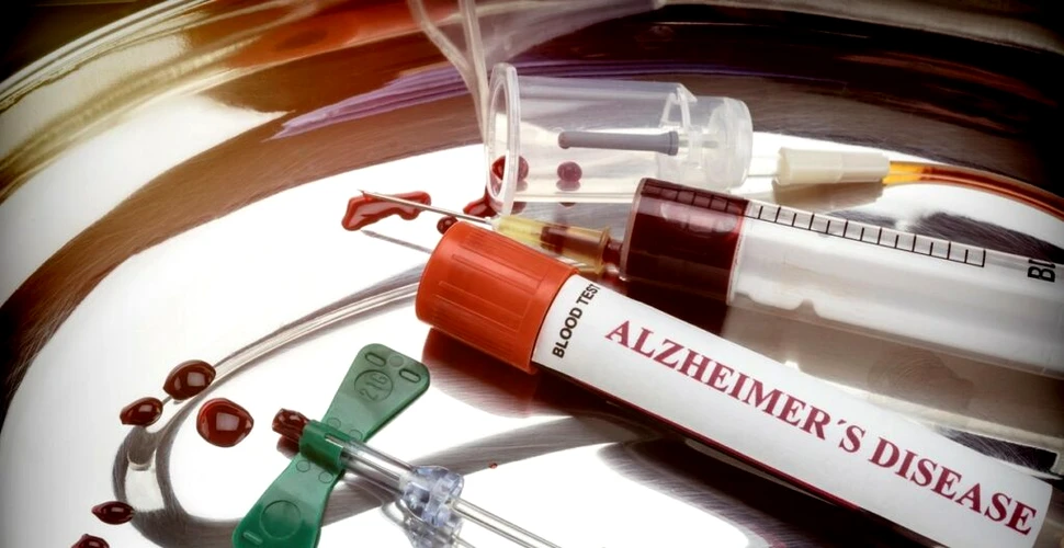 Un test de sânge va putea detecta mai repede boala Alzheimer
