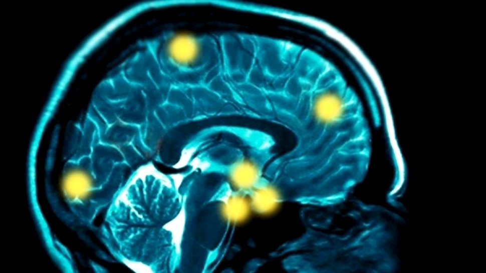 Este bine sa gandim, dar cu masura