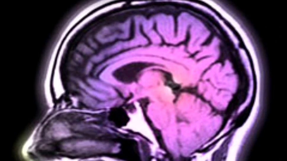 Autismul si schizofrenia sunt inrudite genetic