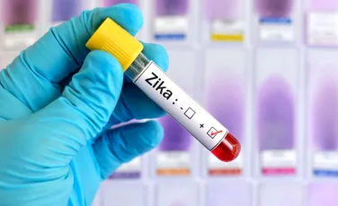 Primul caz de infectare cu virusul Zika a fost confirmat în România