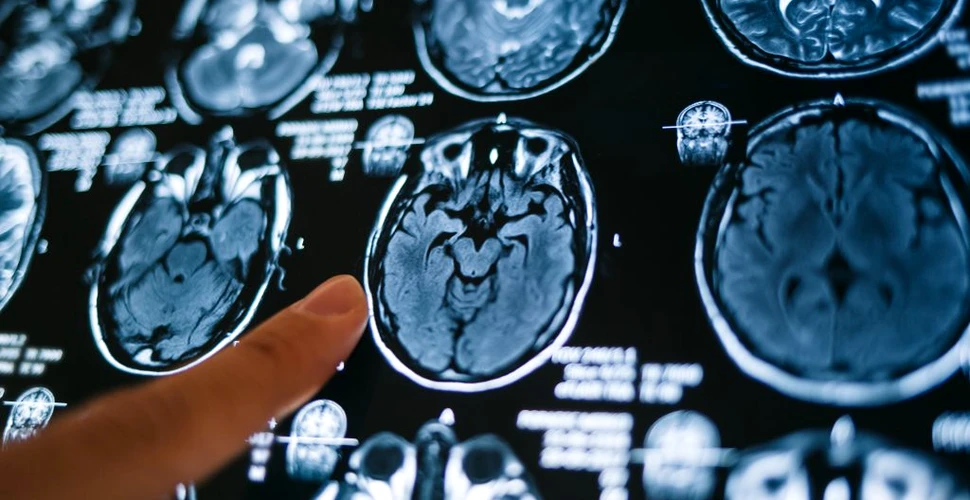 Un nou algoritm poate identifica indicatori ai bolii Alzheimer cu o acuratețe de peste 99%