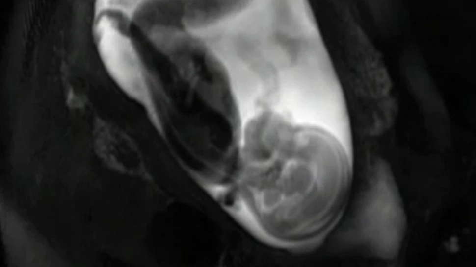 Uimitor: cercetătorii au realizat un material video în care surprind formarea creierului la făt (VIDEO)