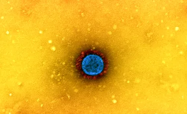Cercetătorii au obținut imagini cu virusul SARS-CoV-2 în timp ce infectează o celulă