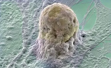 Celulele stem cunosc si “partitura” celulelor nervoase