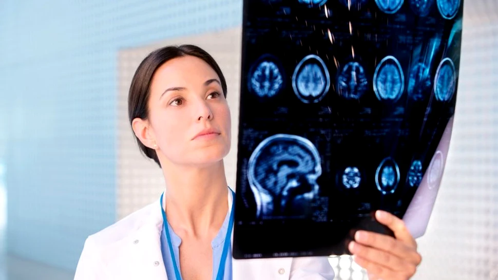 Combinaţia dintre radioterapie şi un medicament împotriva schizofreniei, eficientă împotriva tumorilor cerebrale