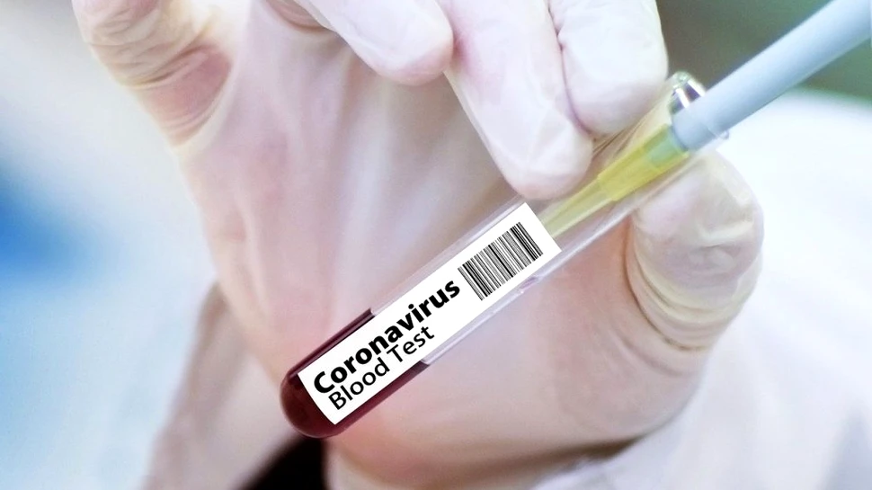 Cele cinci companii alese de SUA care au şanse mari să producă un vaccin anticoronavirus