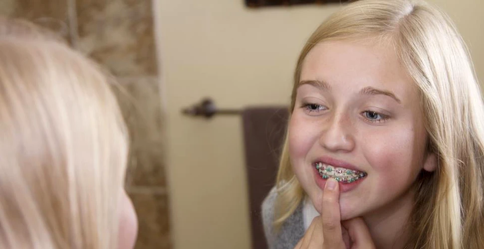 Tot ce trebuie ştiut despre aparatul dentar la copii. Interviu cu un medic ortodont