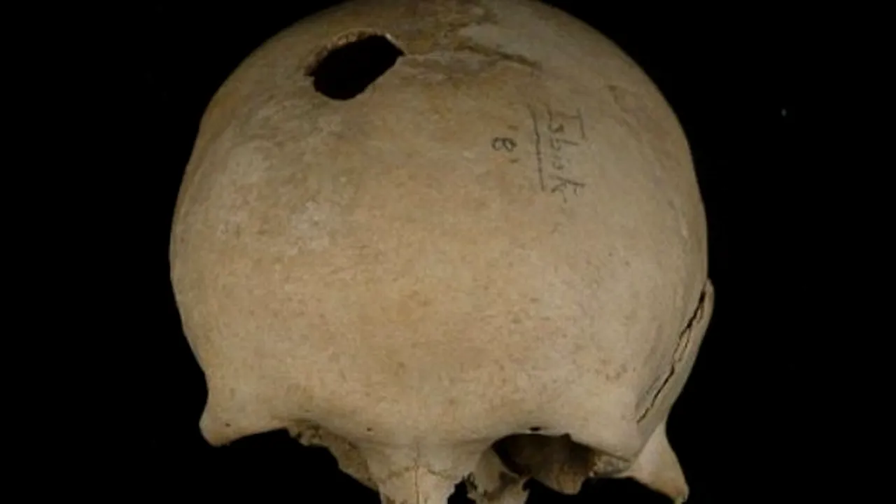 1-craniu 