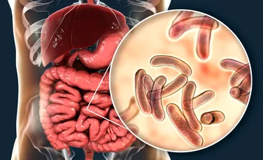 Bolile care nu vor să dispară, în ciuda progreselor din medicină