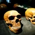 O anomalie cerebrală la oamenii moderni își are originea în ADN-ul neanderthalian străvechi