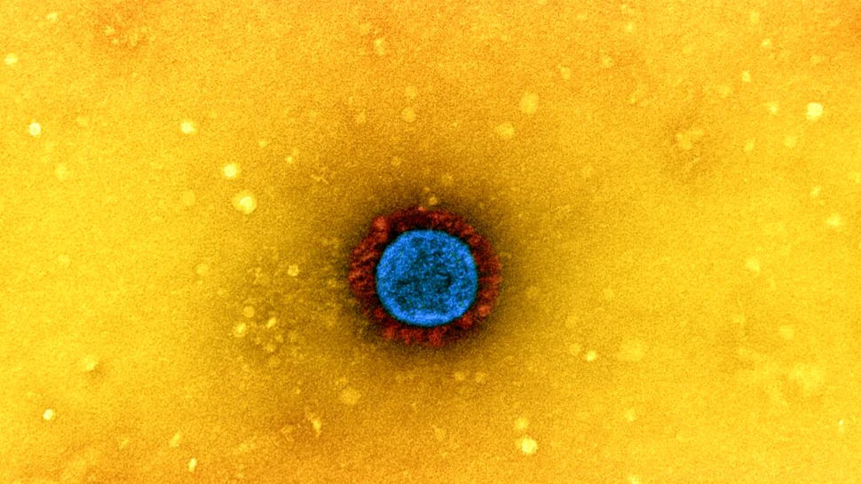 Cercetătorii au obținut imagini cu virusul SARS-CoV-2 în timp ce infectează o celulă