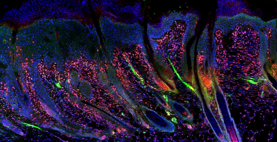 Descoperirea care permite pielii adulte să se regenereze la fel ca cea de nou-născut