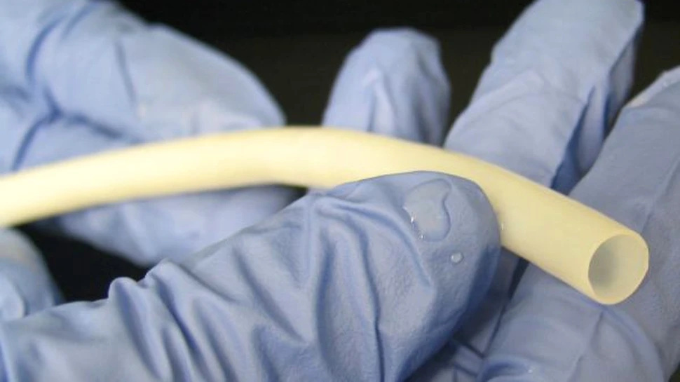 Oamenii de ştiinţă au reuşit să creeze vene artificiale