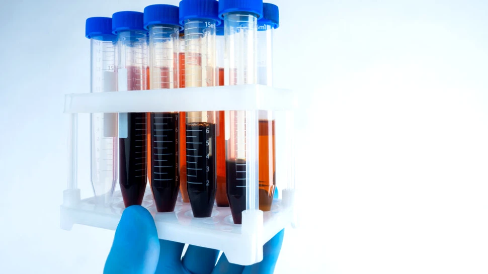 Oamenii de știință au confirmat o nouă grupă de sânge după 50 de ani de cercetări