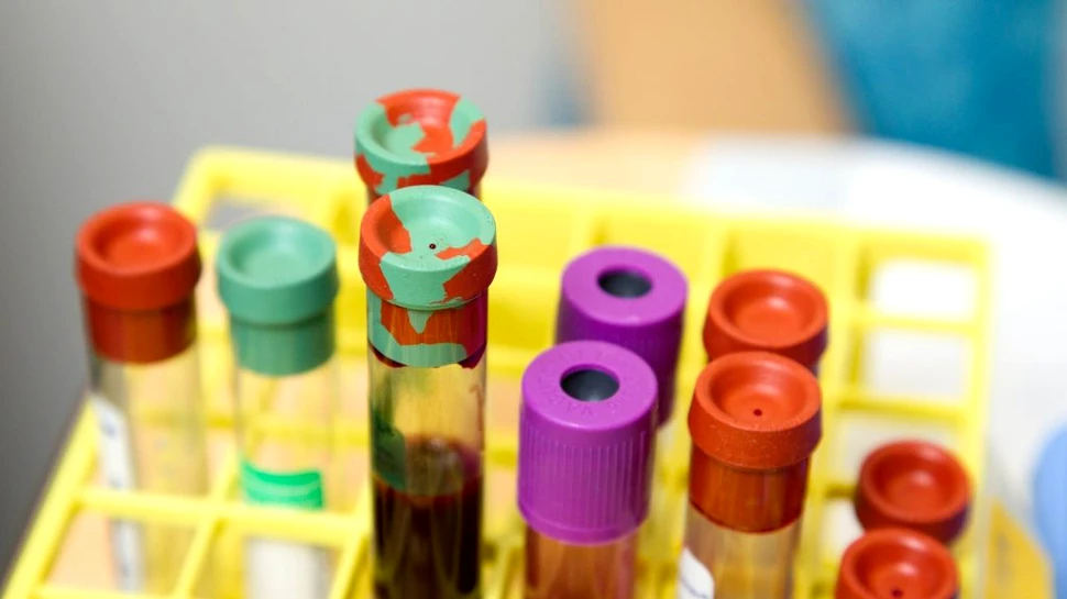 Experții au descoperit că SARS-CoV-2 a suferit mutații, iar noua tulpină este mult mai infecțioasă