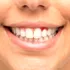 Sângerarea gingiilor ar putea fi un semn precoce al unei afecțiuni mult mai grave