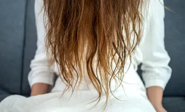 De ce tot mai multe femei solicită transplant de păr?