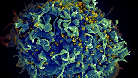 HIV poate accelera îmbătrânirea persoanelor infectate, sugerează un studiu